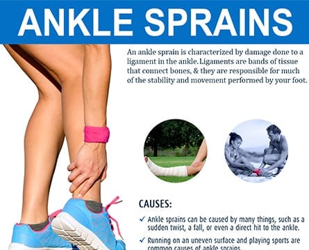 Ankle-Sprains-by-Orange-County-Orthopedic-Surgeons