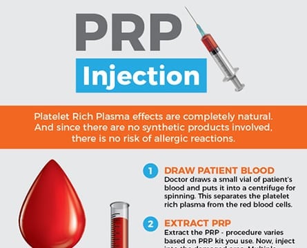 PRP-Injection-thumb