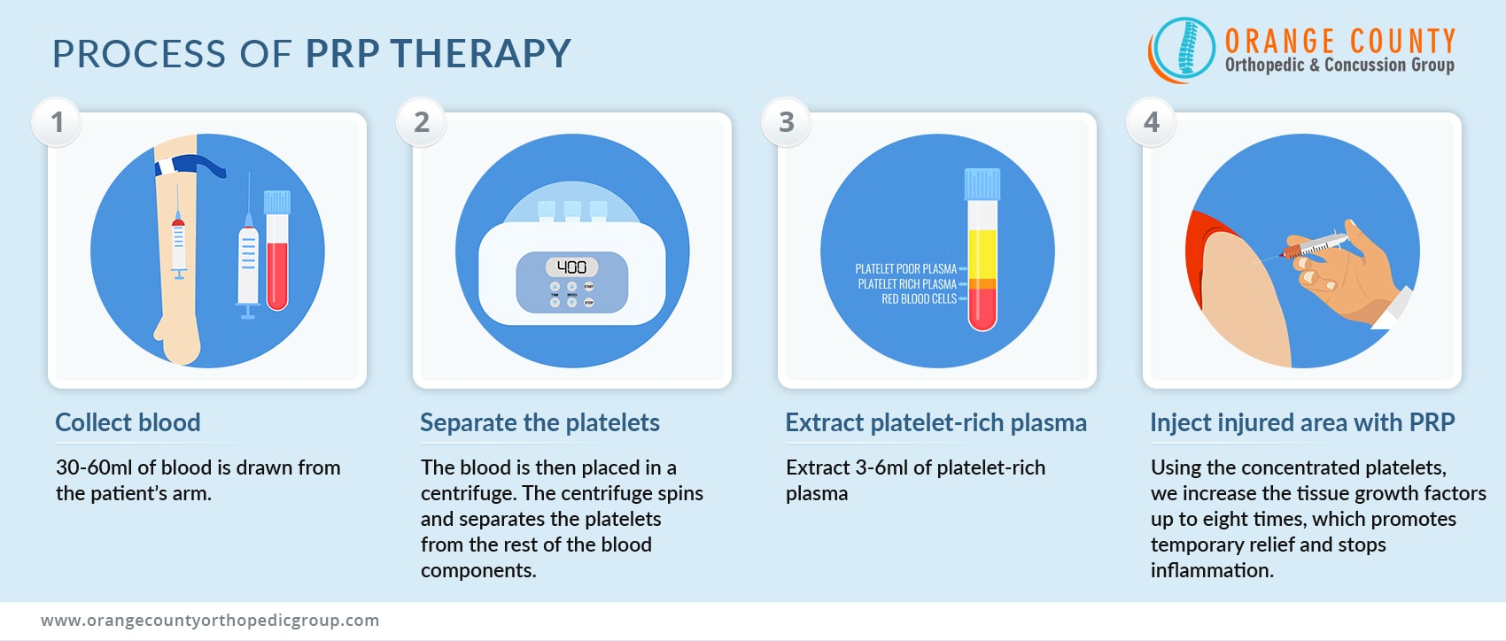 Process-of-PRP-Therapy-OC-Orthopedic-Group