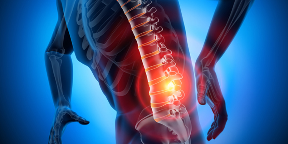 3D-rendering-of-lower-back-pain