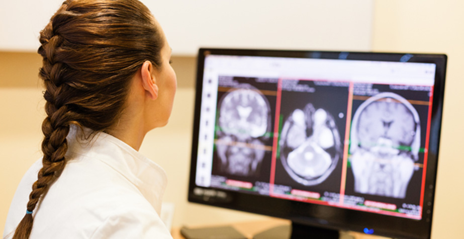 Female-doctor-looking-at-MRI-scan-of-brain