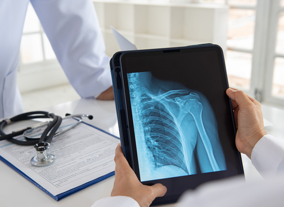 Physician-analyzing-x-ray-of-shoulder