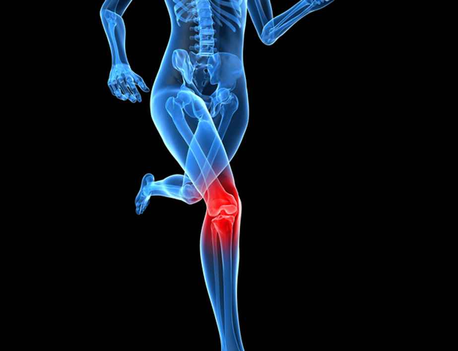 Running-female-skeleton-with-knee-pain